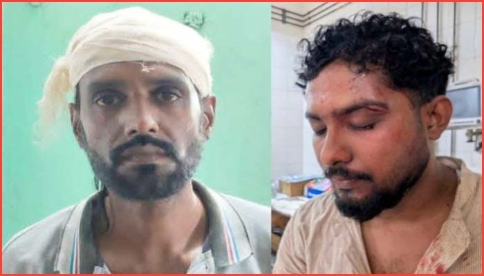সিলেটে  ইন্টার্নি চিকিৎসকদের হামলায় আহত দুই সাংবাদিক